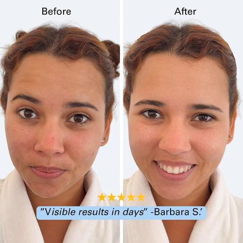 Face Cleaner Pro™